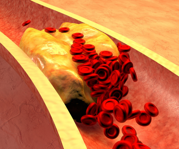 Research has shown that the food we eat can affect the levels of inflammation found in our bodies.