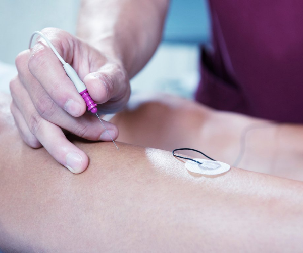 EMG is sometimes used to test for sciatica.