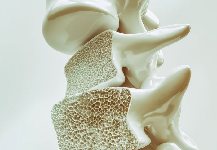 Over time, wear and tear of the disc and facet joints can cause osteoarthritis of the low back.
