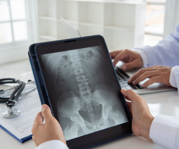 Doctors don't always know what causes pain in your lower back