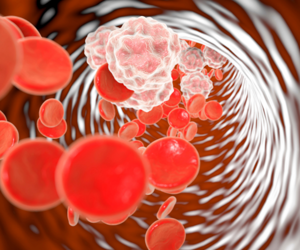 localized inflammation can be one cause of low back pain.