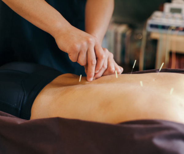 Acupuncture is a type of medicine based on an ancient traditional Chinese form of healing