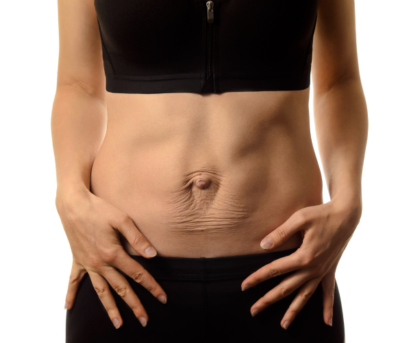Muscle separation in pregnancy can cause pain in the lower back since the core muscles are not able to support it properly.