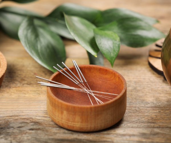 Acupuncture is often used as add-on therapy for managing chronic back pain.