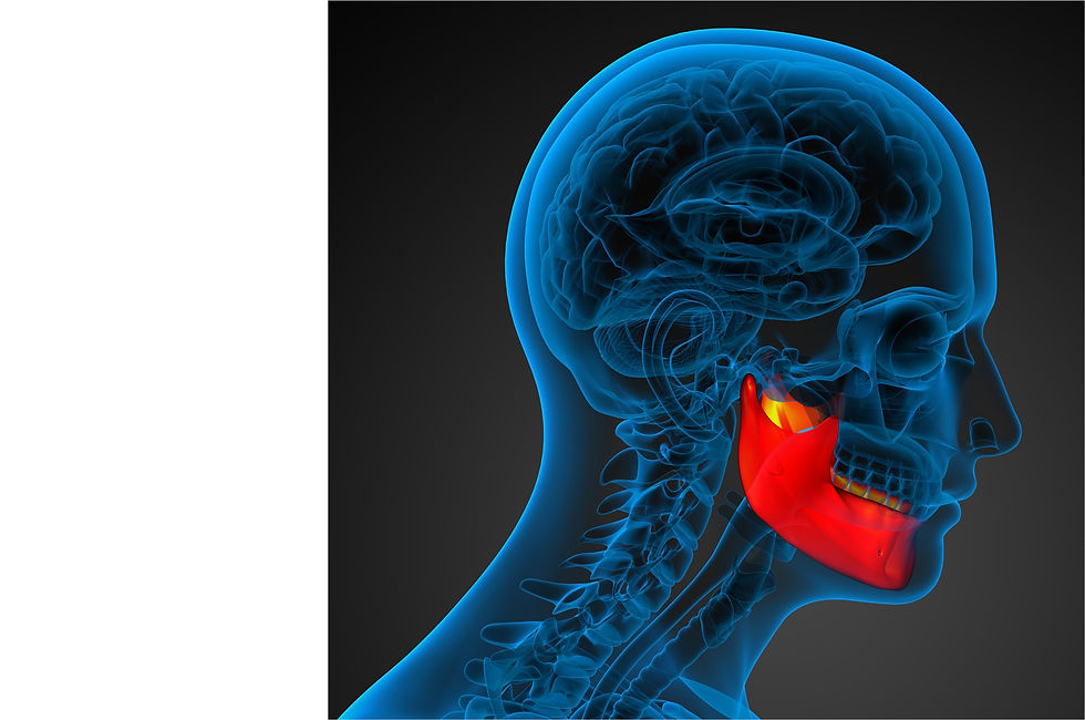Bruxism Awareness Week: Understanding and Managing Tooth Grinding