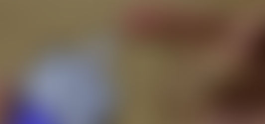 Saúde: Senado aprova projeto que reconhece diabetes tipo 1 como deficiência