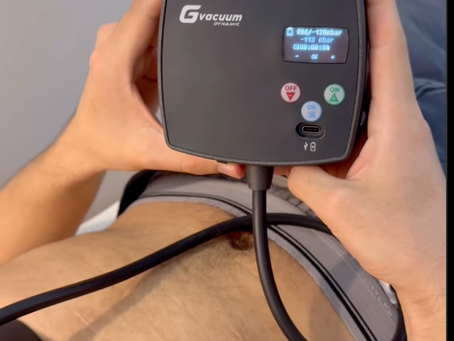 Gvacuum 다이나믹 진공 펌프를 통한 오목가슴 치료의 새로운 시대
