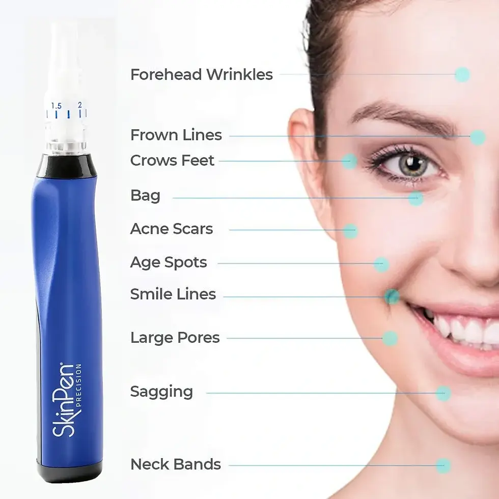 SkinPen treatment areas