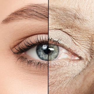 Close-up split image of an eye, left side youthful with smooth skin, right side aged with wrinkles. Clear contrast in skin texture.