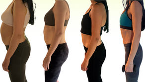 Progress of healing diastasis with a hernia