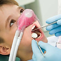 nitrous-oxide-sedation.jpg