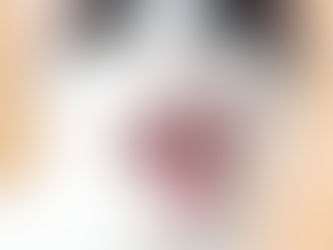 難治性口内炎は治療できます