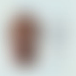 O que você precisa saber antes de fazer um clareamento dental?