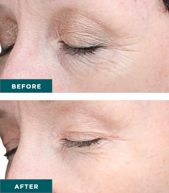 before-and-after-4_553x