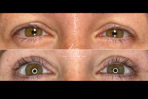Click here for more before and after photos.