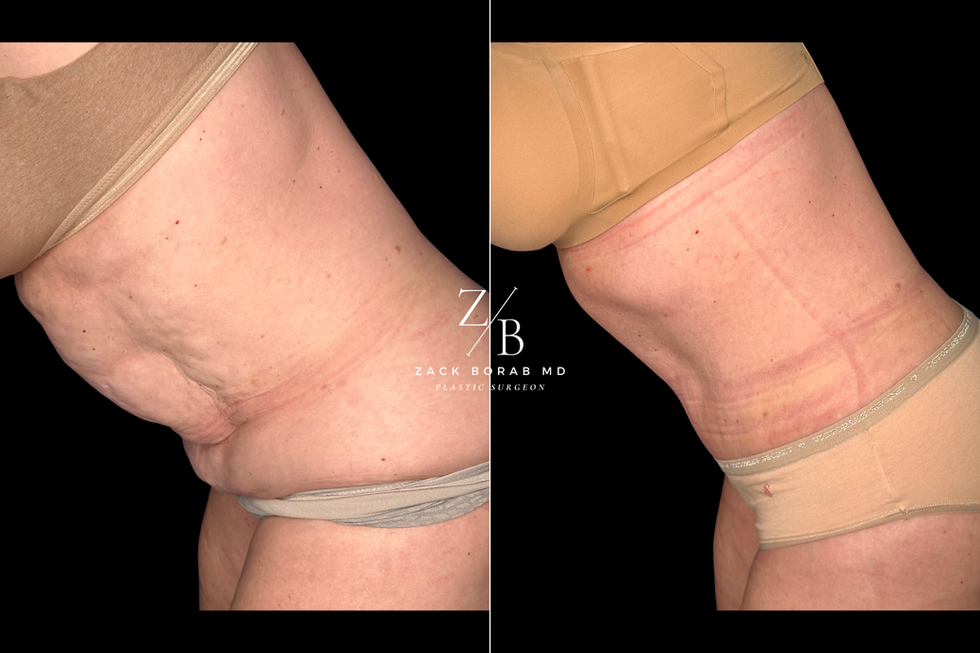 277 lat bend key.png