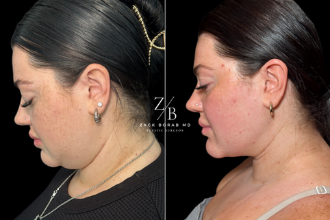 Click here for more before and after photos.