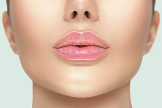 juvederm-volbella-banner (1).jpeg