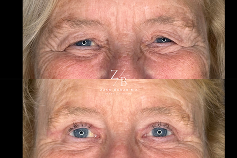 Click here for more before and after photos.