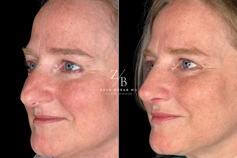 Click here for more before and after photos.