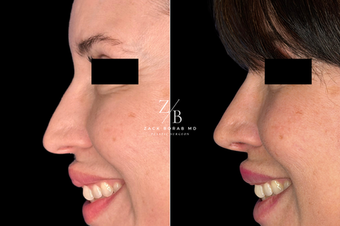 Click here for more before and after photos.