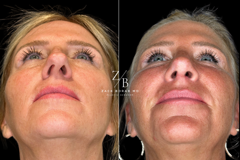 Click here for more before and after photos.
