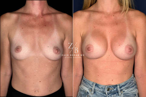 Click here for more before and after photos.