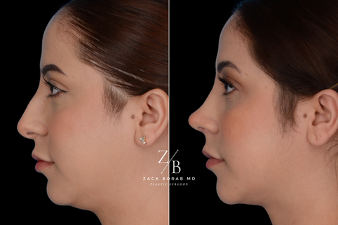 Click here for more before and after photos.