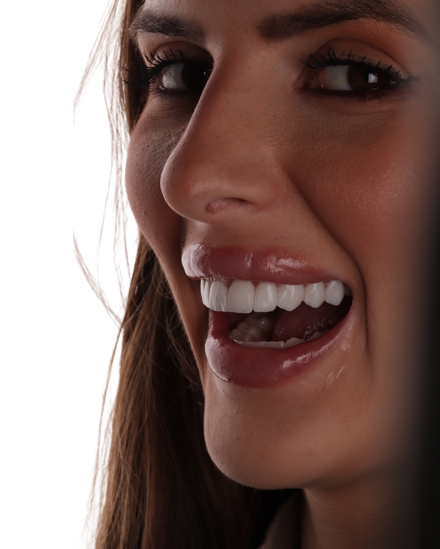 Paciente sorrindo após colocar lentes de contato dental em resina composta em Balneário Camboriú