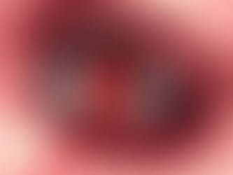 Paediatric Ocular Trauma: What the Experts and Ophthalmologists Needs to Know