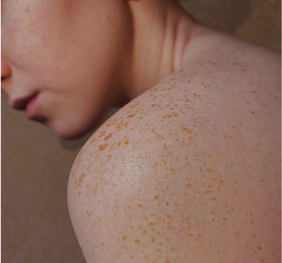 Facials Wirral