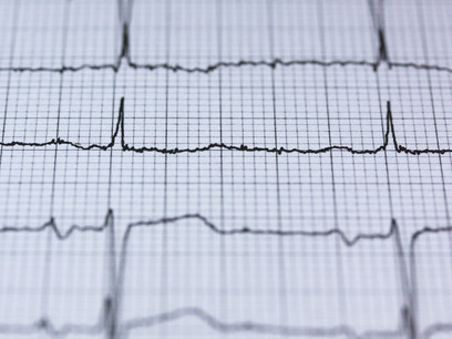 Doctors making efforts re Patients’ end-of-life instructions