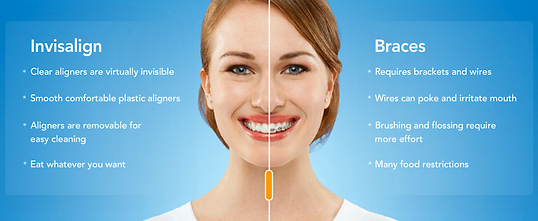 Mississauga Valley Dental | Orthodontic | Braces | Mississauga