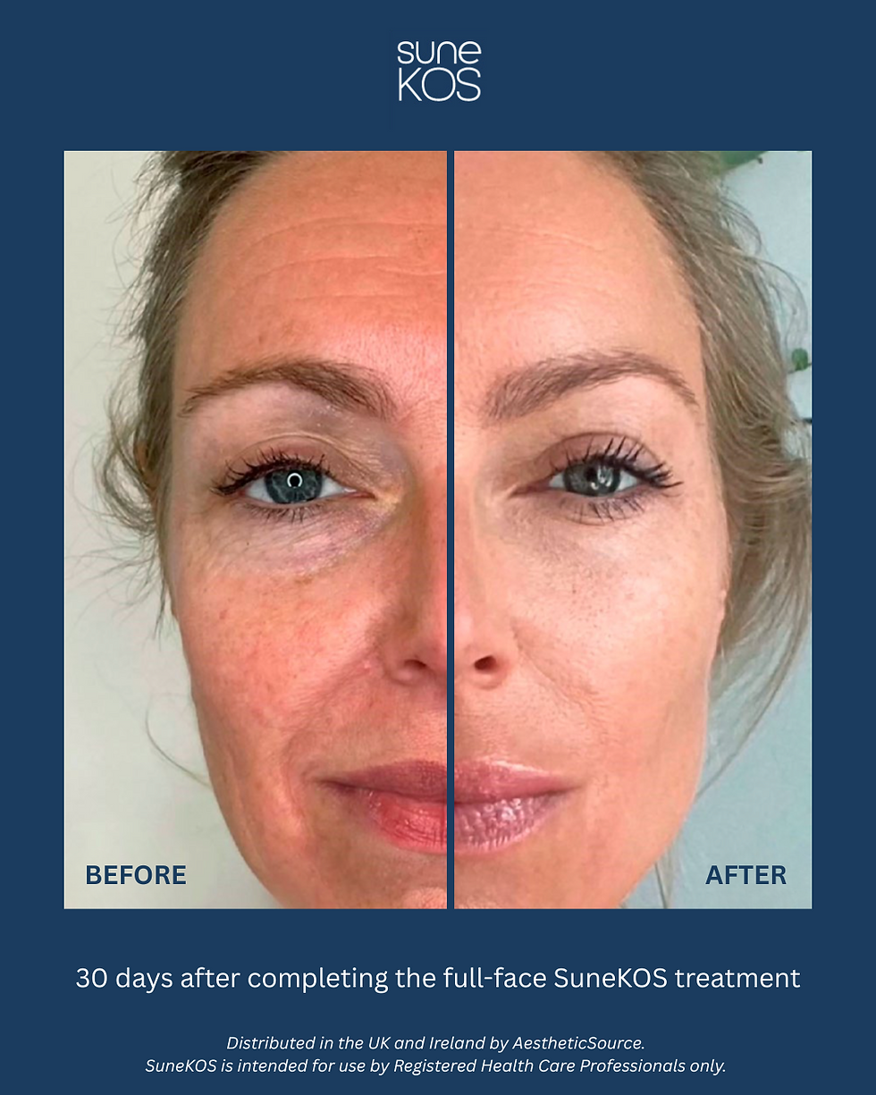 SuneKOS_Before & After1.png