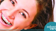 6 situações em que você precisa usar aparelho dentário