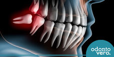 Sobre cirurgias odontológicas