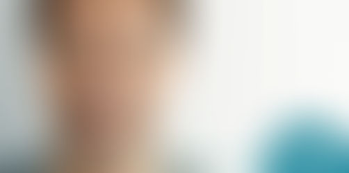 Restaurações de resina: evolução tecnológica aliada à estética
