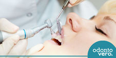 Profilaxia: entenda a limpeza dentária profissional