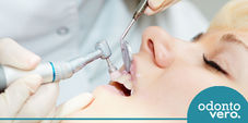 Profilaxia: entenda a limpeza dentária profissional