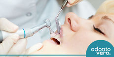 Profilaxia: entenda a limpeza dentária profissional