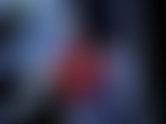 FEMUR KIRIĞI ÖZÜR ORANI (UYLUK KEMİĞİ) - TRAFİK KAZASI TAZMİNATI