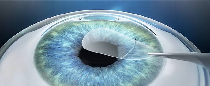 Eye Photo