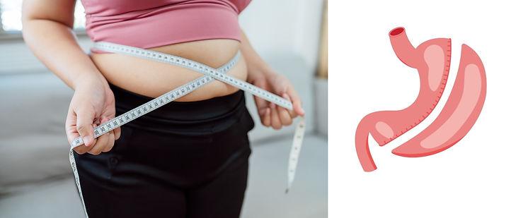 Fat Woman and Stomach Photo