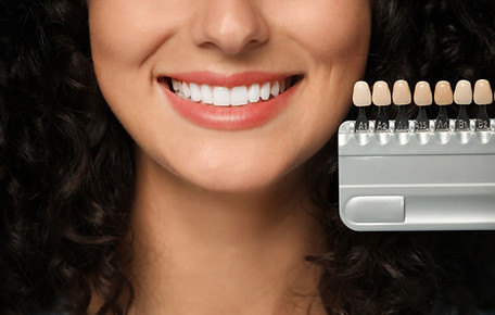HOLLYWOOD SMILE