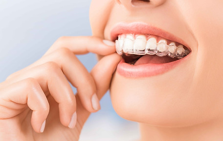 INVISALIGN TREATMENT