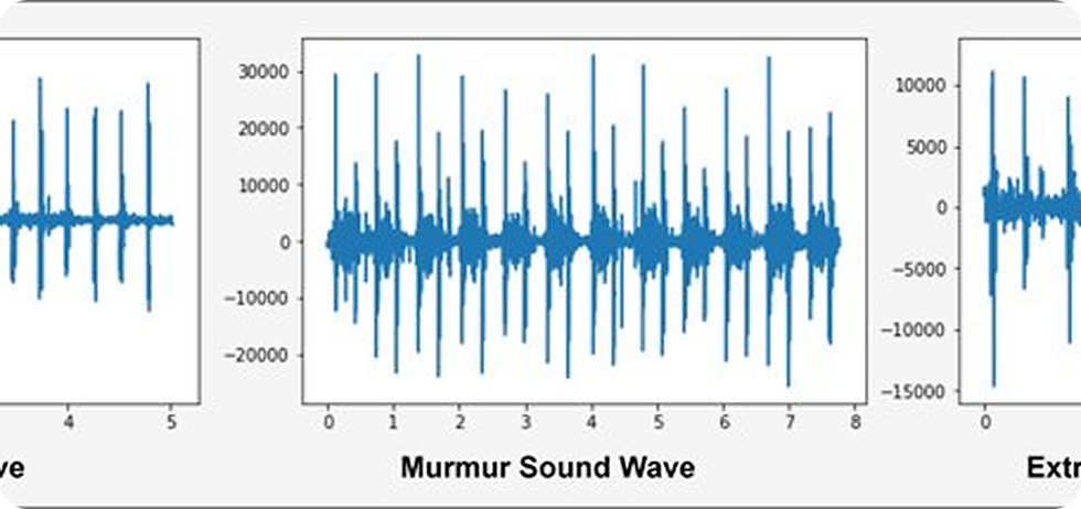 Heartbeat Sound Abnormality Detection