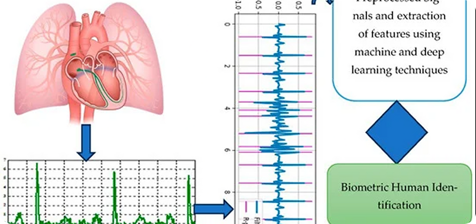 ECG-Based Authentication Technology