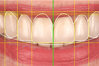 cosmetic_dentistry.png