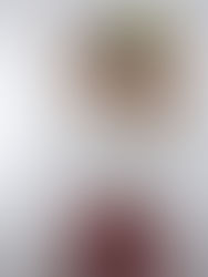 Can Exercise Help with Lower Back Pain?