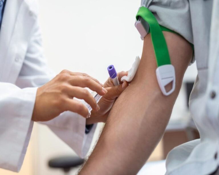 Vascular Surgeon Near Me for Spider Vein Treatment